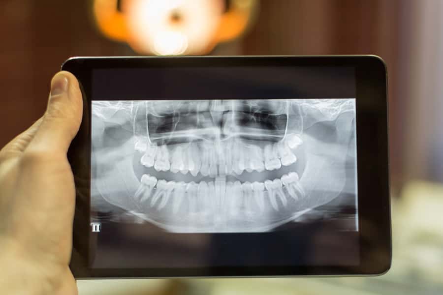 Digital Radiography in Chicago, IL